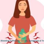 Excess Bleeding in Periods: Causes, Symptoms & Treatment